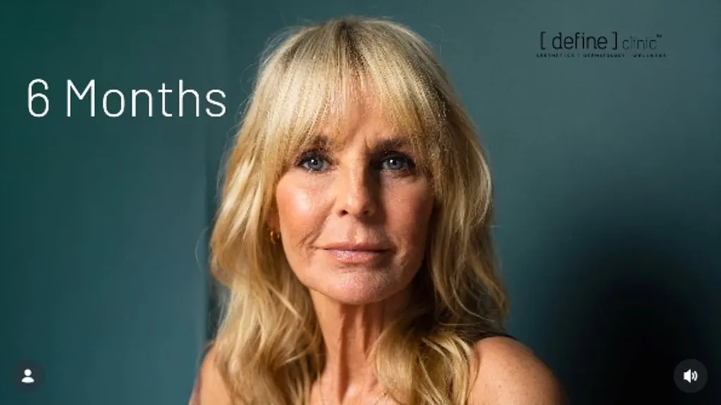 Ulrika Jonsson, 58, reveals what she had done to her face