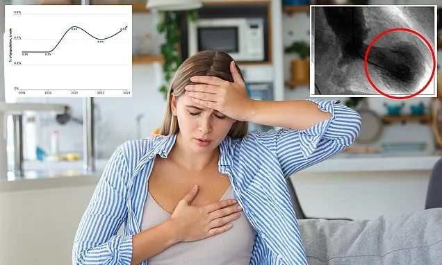 Rare condition that mimics heart attack can strike even healthy people