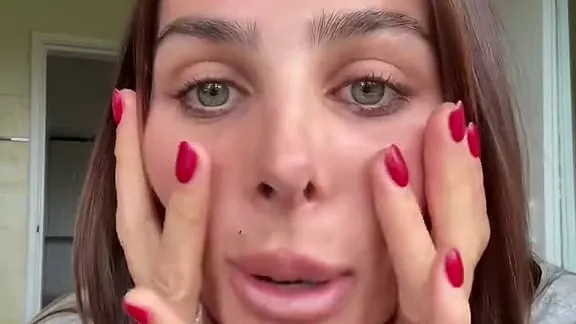 TikTok star Indy Clinton addresses her uneven nostrils after nose job