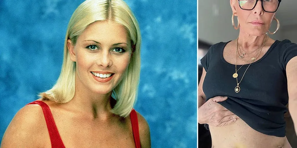 'Baywatch' star Nicole Eggert undergoes major cancer surgery after alarming test results