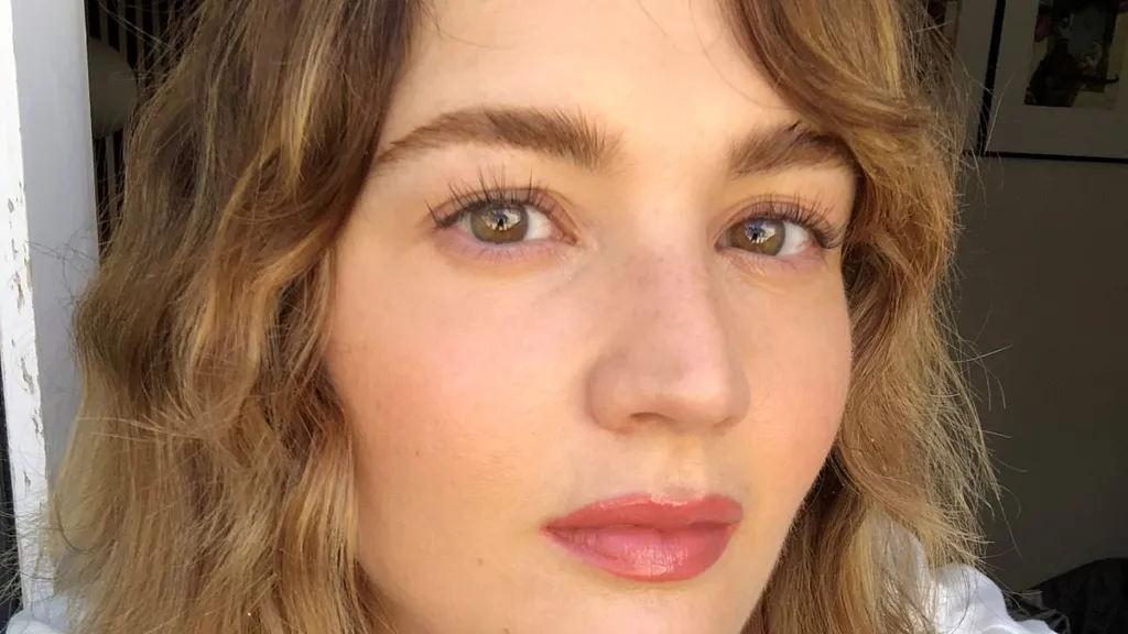 I've had a skin condition for 10 years. Here are the everyday triggers