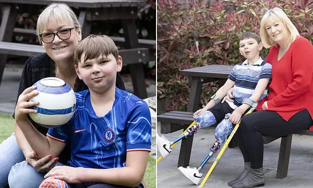 Tony Hudgell's adoptive mother has undergone 'brutal' surgery