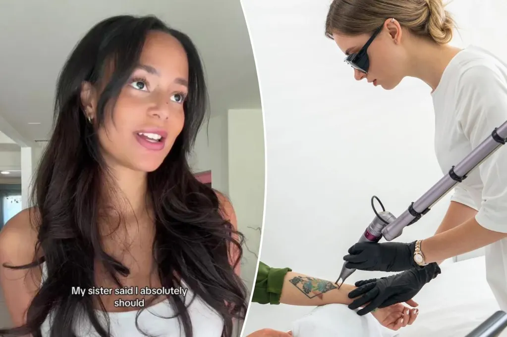 Influencer reveals 'disgusting' complication of tattoo removal