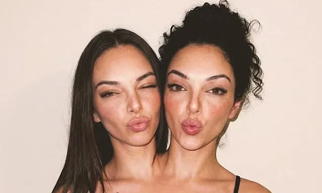 Conjoined twin 'influencers' with 280,000 followers revealed to be AI