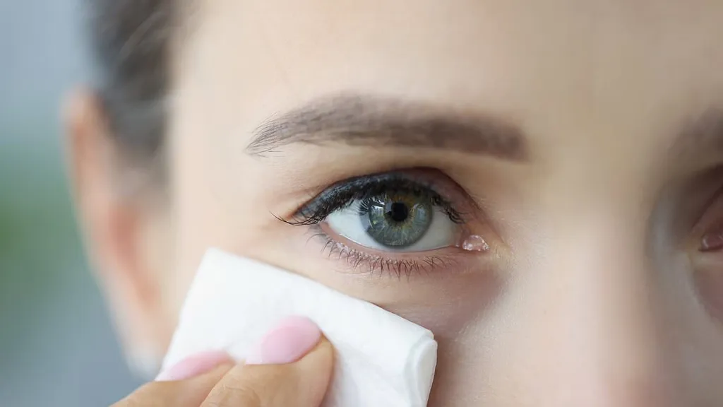 My watery eyes ruined my life - but these lifestyle tweaks can help