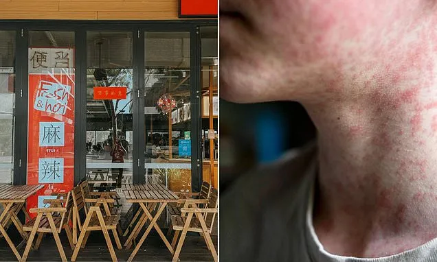 Urgent health alert as authorities admit virus is CIRCULATING