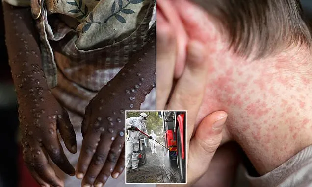 Infectious disease expert reveals the viruses to worry about in 2026