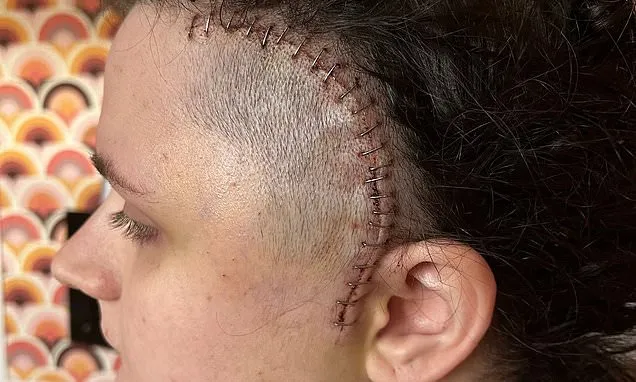 Student to be 'first in queue´ as new brain tumour treatment...