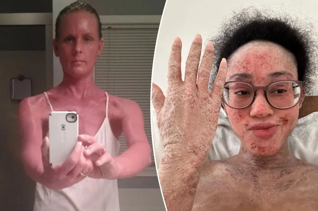 Exclusive | The scary condition sufferers say 'traps you in your own half-alive...