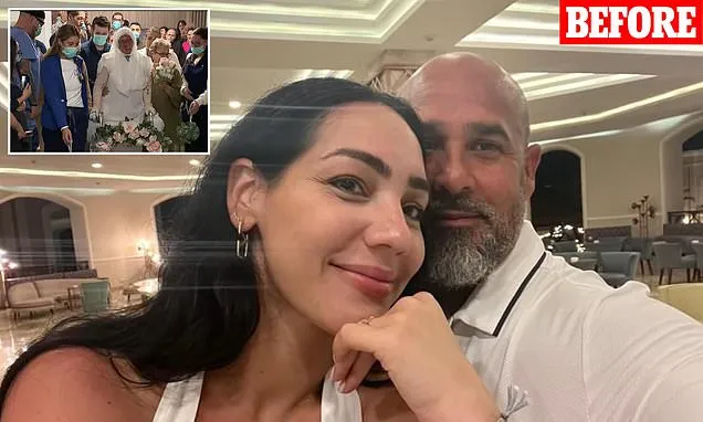 Burn victim gets married at hospital after grill exploded in her face