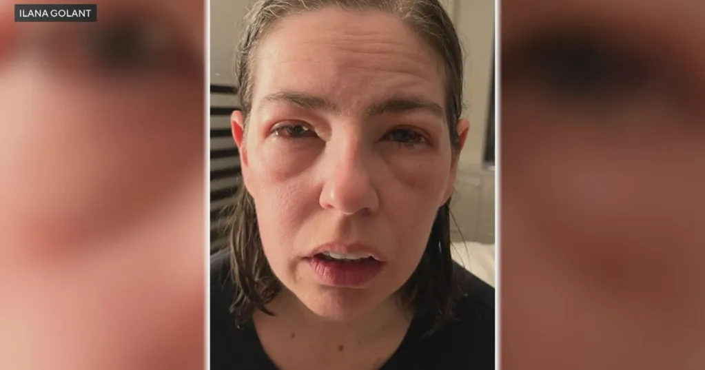 Northwestern University scientists say asthma drug zileuton could stop life-threatening food allergies