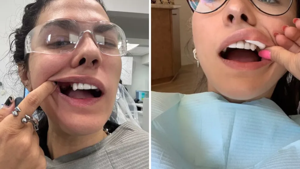 Millennial woman left with over $30k dental work after eating disorder
