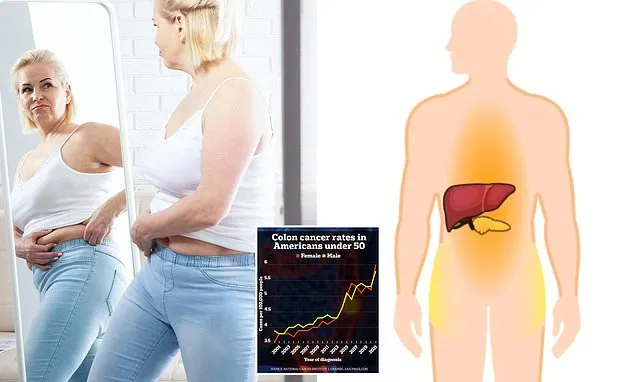Where fat collects could signal increased risk of an array of diseases