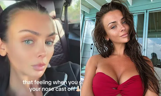 Kady McDermott reveals her 'secret nose job' to stunned fans