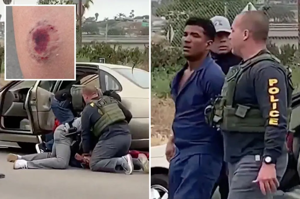 Vile photo shows gruesome bite mark on ICE officer after alleged Tren...