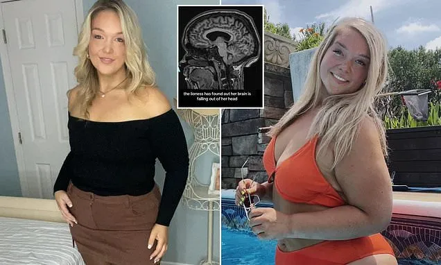 Shelli was often dizzy. Doctors discovered her brain was 'falling out'