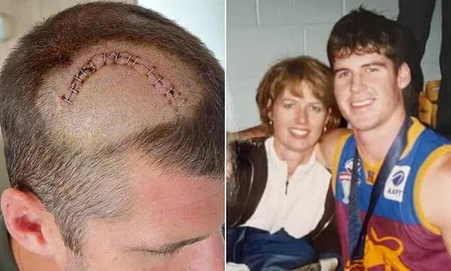 Footy legend says late mum helped save him from brain tumour scare