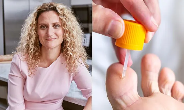 How to deal with horrible warts: DR ELLIE