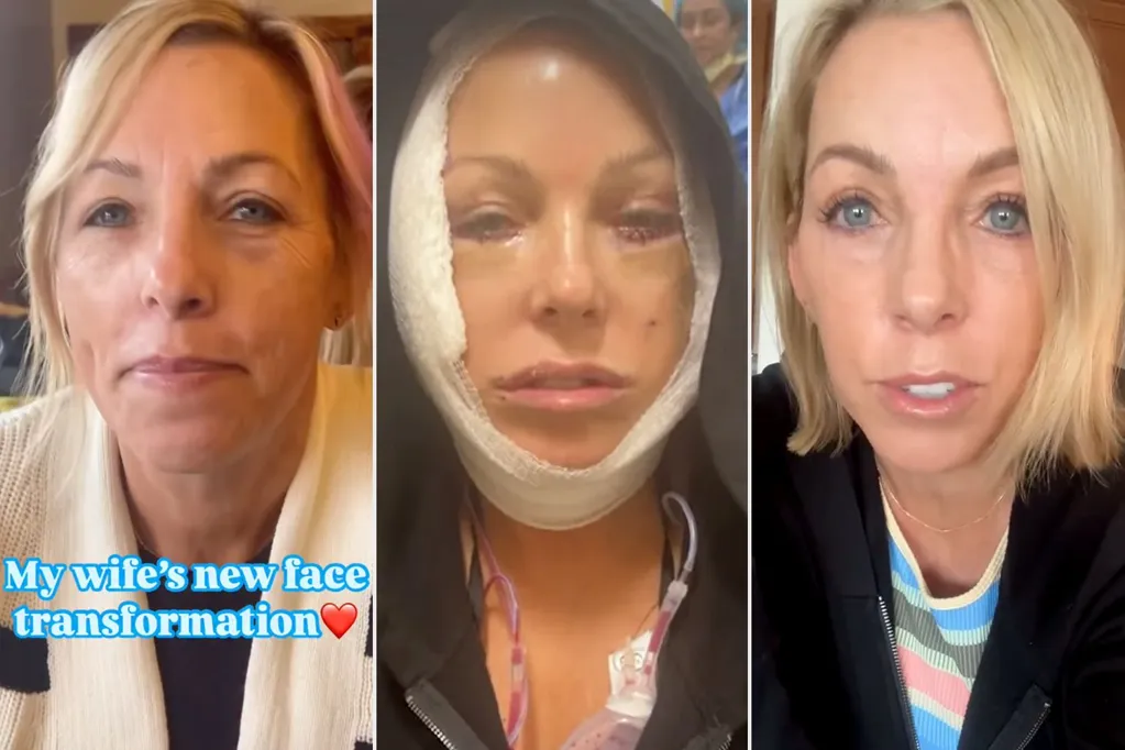 Couple Goes Viral After Husband Documents Wife's 'New Face Transformation' (Exclusive)