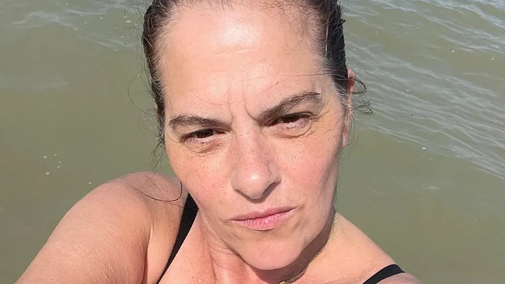 Tracey Emin shares powerful topless snap showing her stoma bag