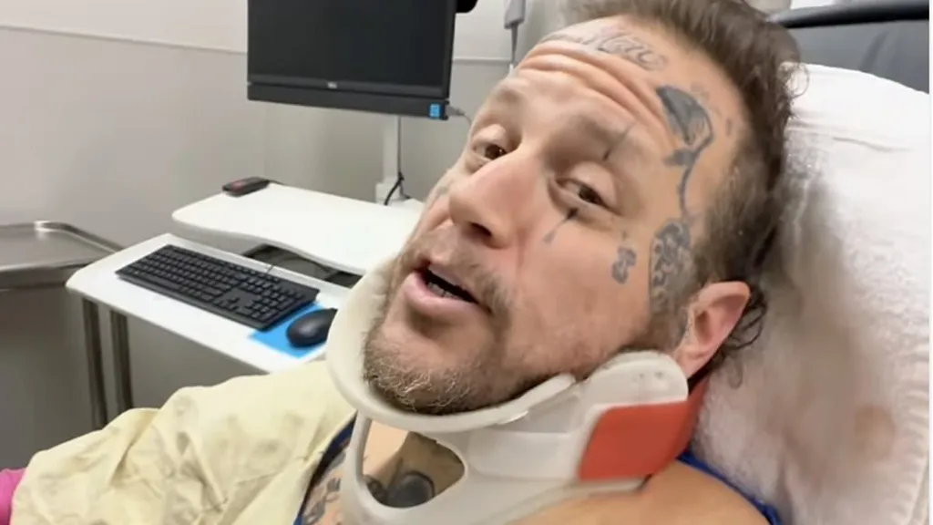 Jelly Roll reveals he attended 2026 Grammys with a broken collarbone