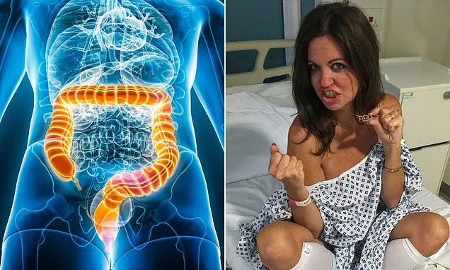 Why bowel cancer is surging in young people in Britain...