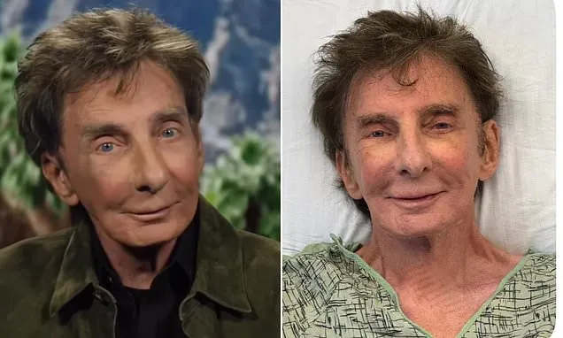 Barry Manilow tells fans he 'made it' amid 'agony' of cancer recovery
