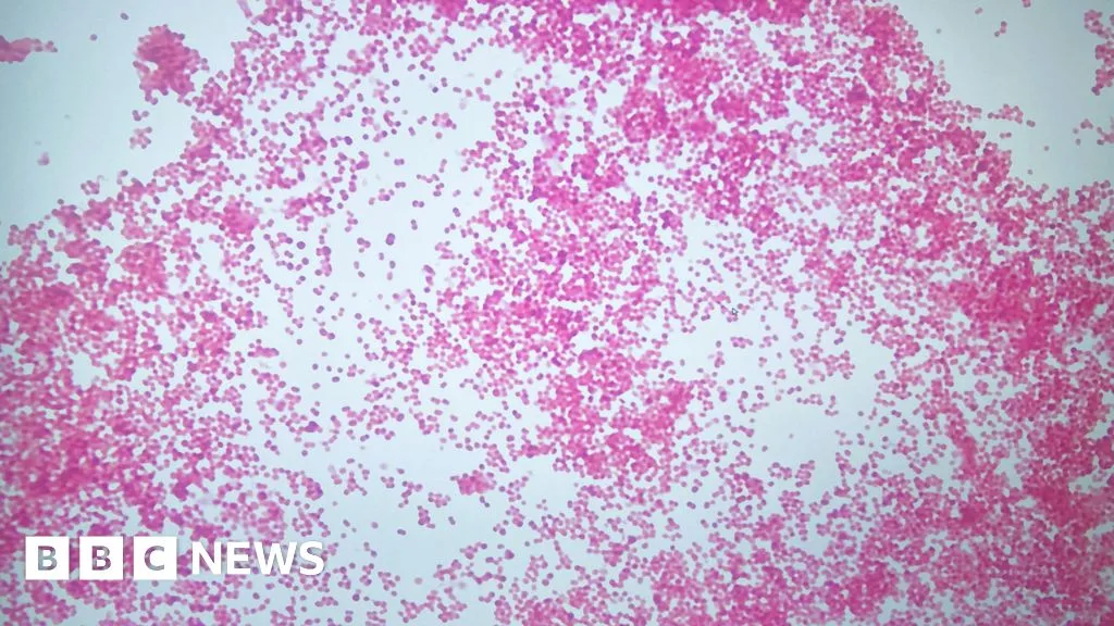 Meningitis: Officials reassure parents suspected case not linked to Kent outbreak