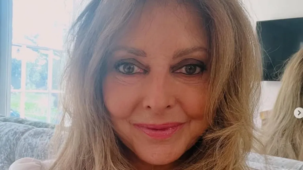Carol Vorderman reveals the unlikely treatment she's had to her face