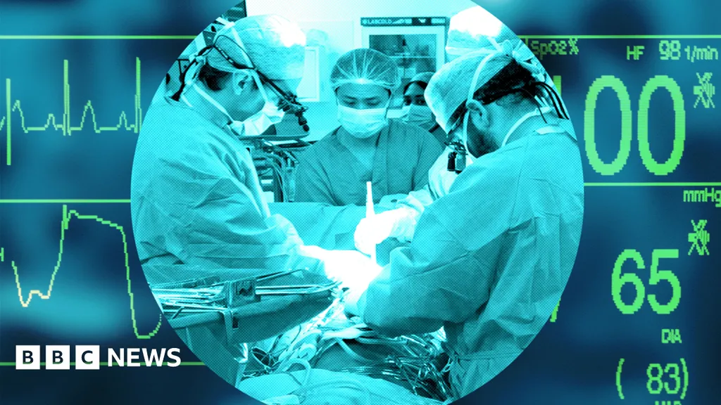 UK transplant system, once world-leading, now lags behind