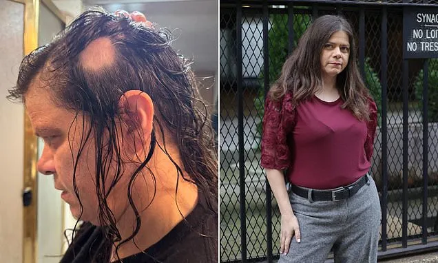 I feared I'd go bald... Then I found a $1 at-home treatment