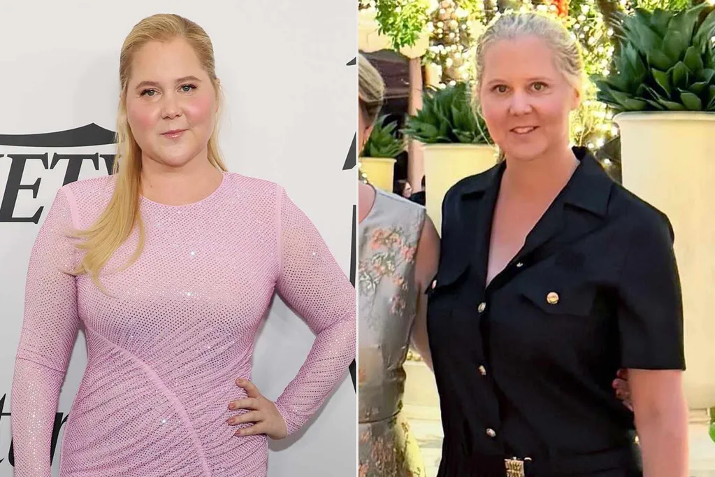 Inside Amy Schumer's Weight Loss Journey: Everything the Comedian Has Said About Her Health