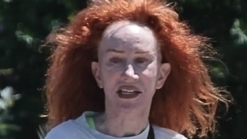 Kathy Griffin's new facelift REVEALED