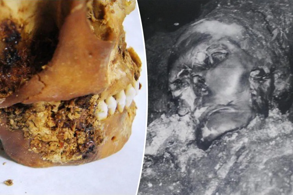 Gnarly 2,500-year-old Siberian mummy is earliest case of complex jaw...