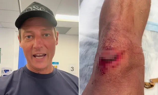 Merrick Watts rushed to hospital after suffering a SHOCKING injury