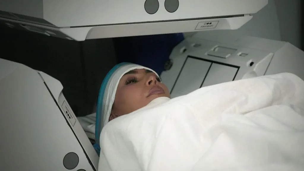 Hidden signs you have a deadly brain aneurysm like Kim Kardashian