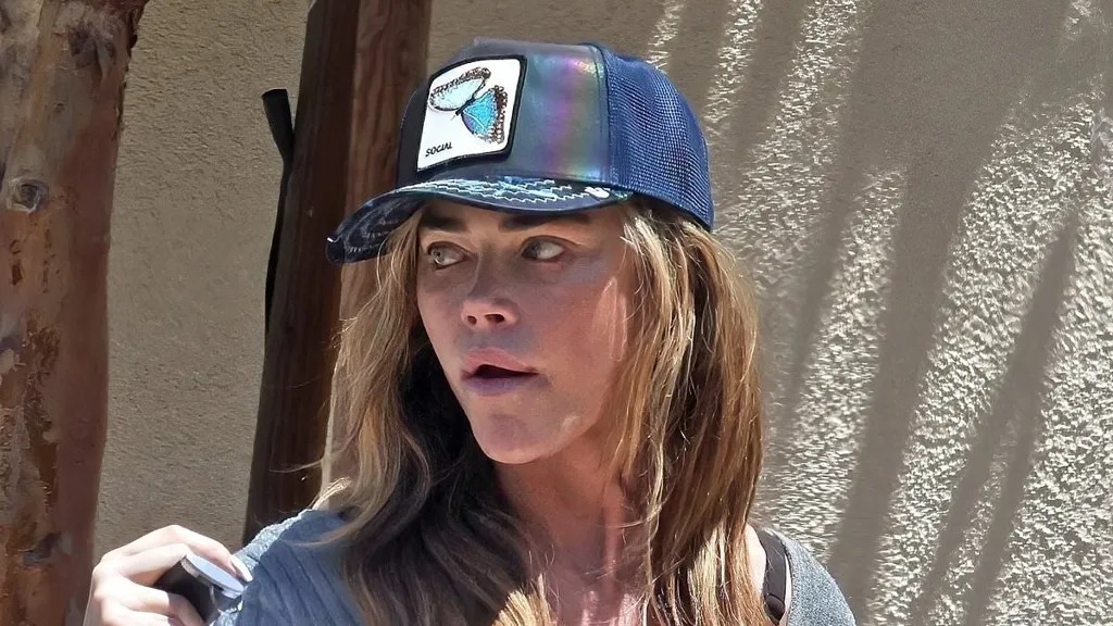 Denise Richards seen with 'black eye' days after cop confrontation