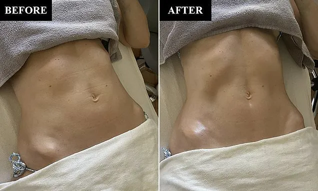 Is a lymphatic drainage massage the secret to a flat tum?