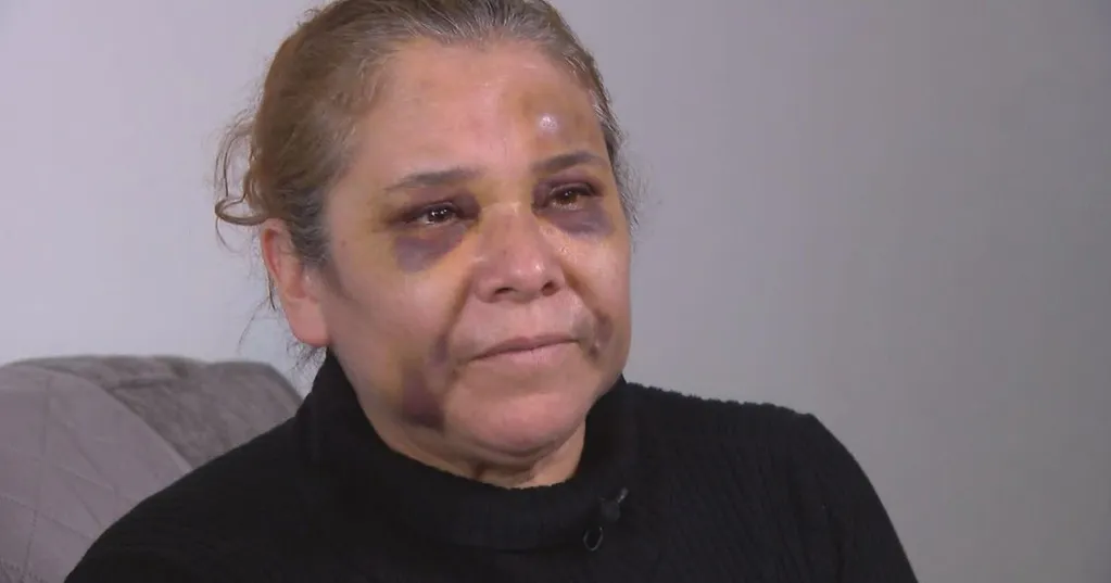 Woman attacked by accused killer of CPD officer shares story of beating at Family Dollar store