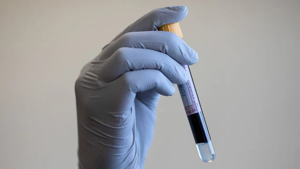 Blood test could identify kids at risk of diabetes and heart disease