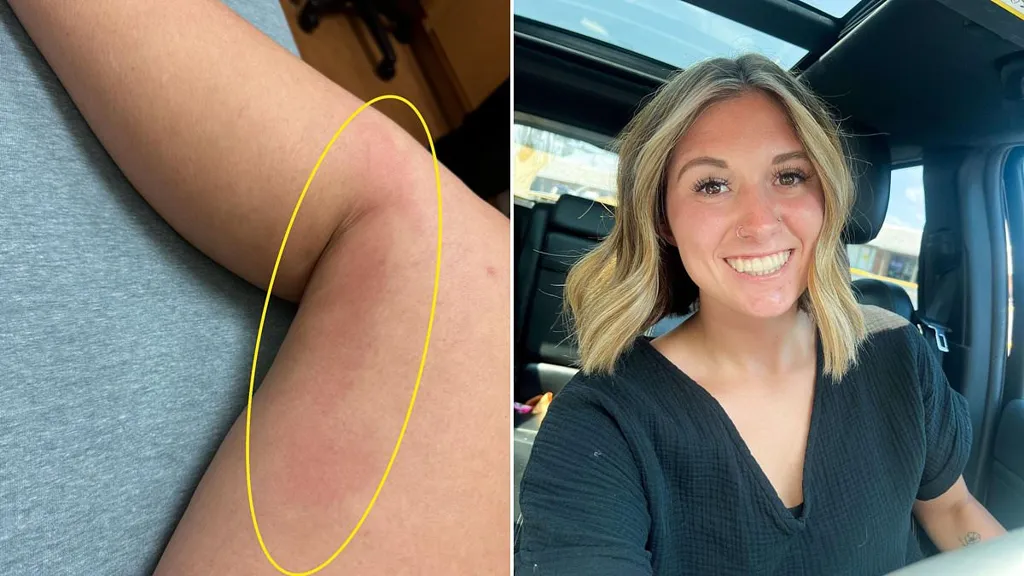Mom reveals how subtle red mark was actually sign  of deadly issue