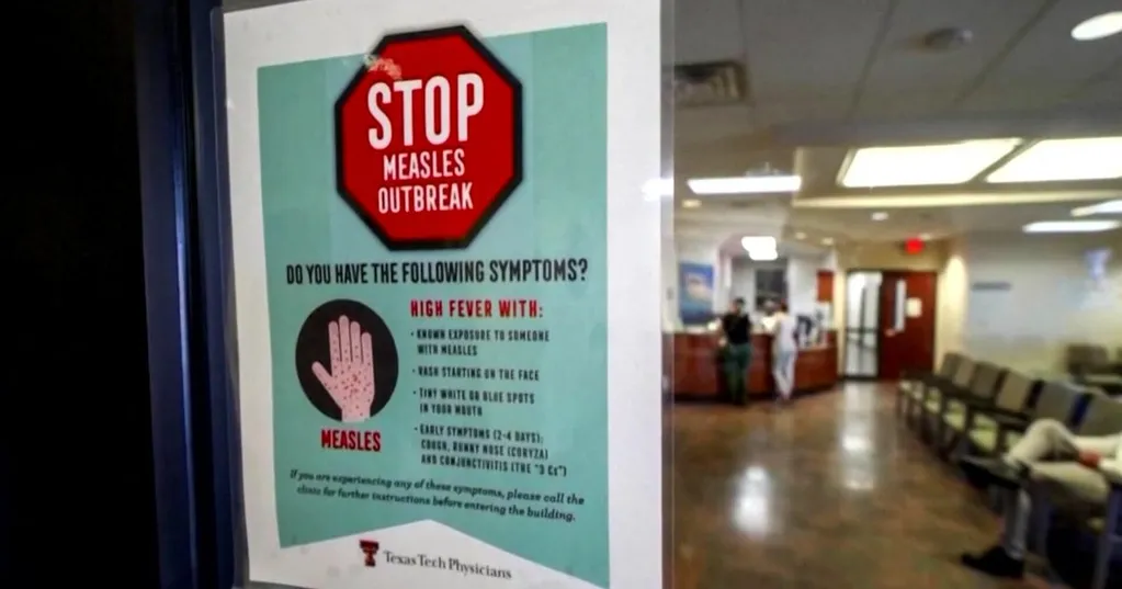 Sacramento, Placer counties work together to stop measles outbreak amid rise in cases
