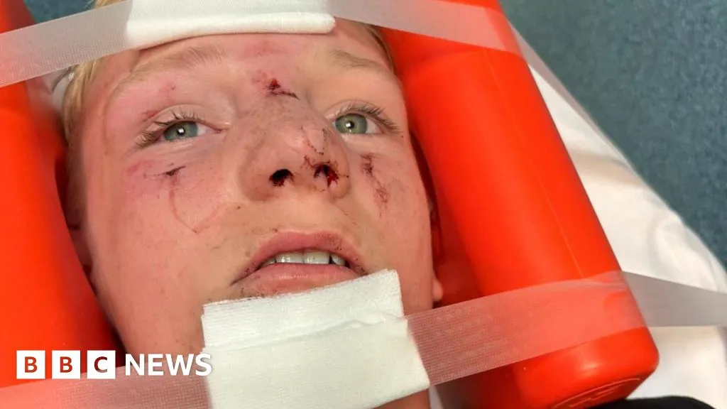 Bolton mum: 'Surgeon said my son's bicycle helmet saved his life'