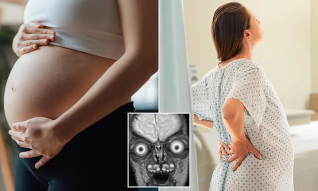 Disturbing images reveal worrying truth behind MRIs in pregnant women