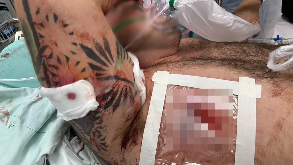 British tourist is shot in road rage attack