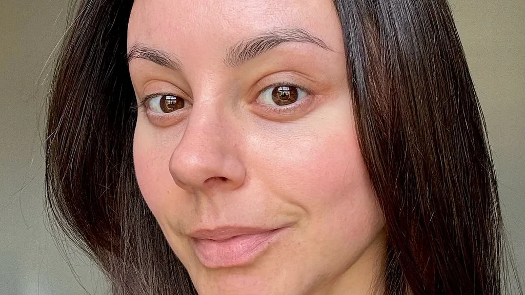 How I finally got my skin-picking under control
