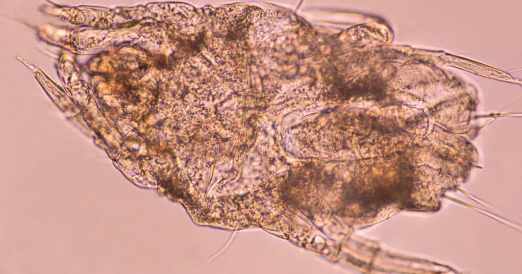 Your Dead Skin Is The 'Favorite Food' Of These Critters  --  And They're Living In Your Bedroom