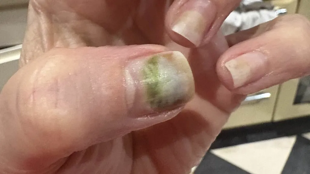 Warning EVERY woman should read before their next manicure