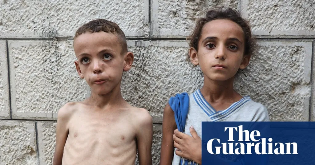 'We faced hunger before, but never like this': skeletal children fill hospital wards as starvation grips Gaza