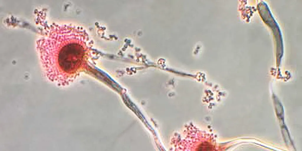 Fungal infections are getting harder to treat